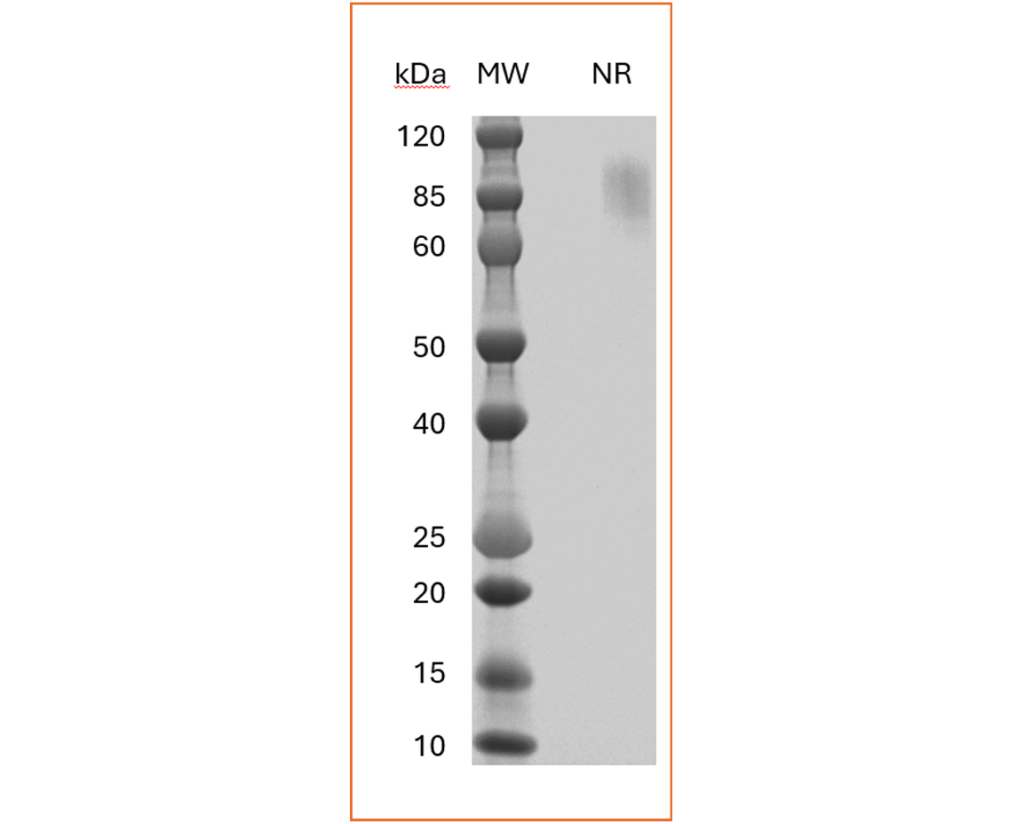 Human TIGIT Dimer SDS-PAGE
