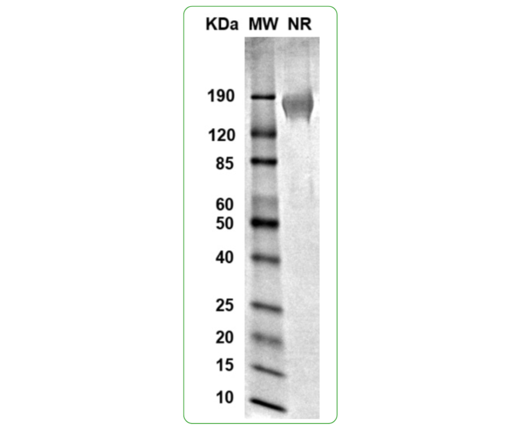 CD155 SDS-PAGE