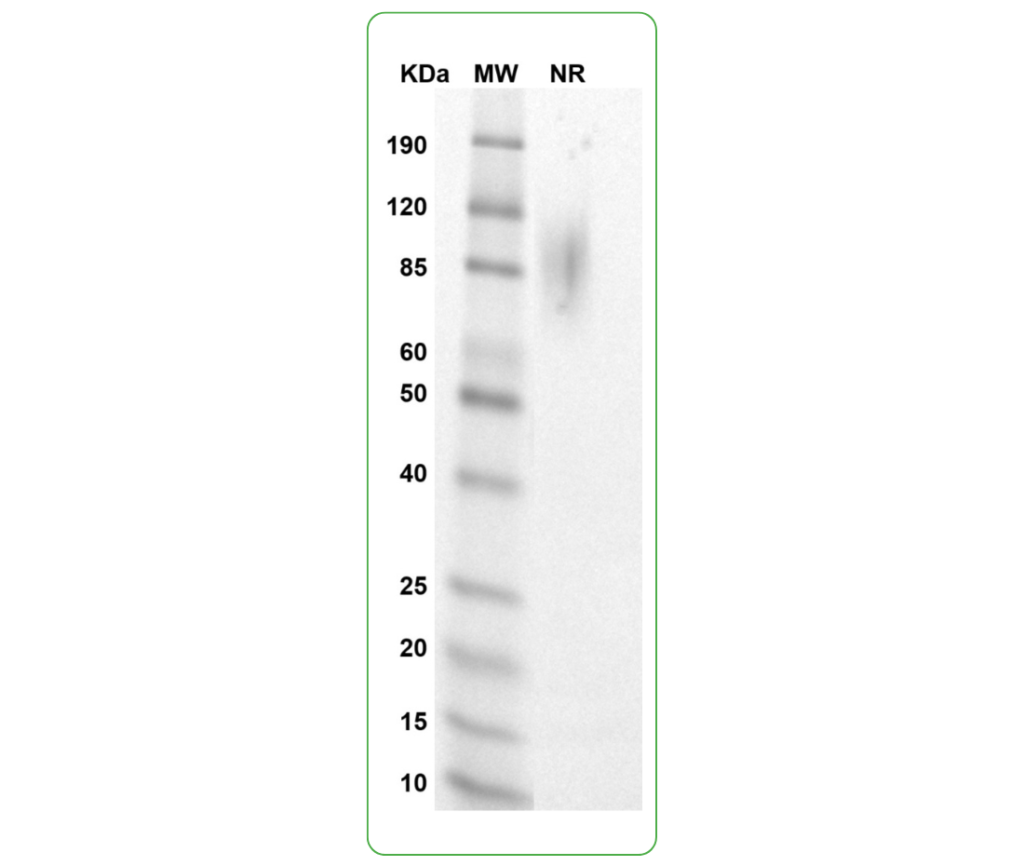 CD28 His tag SDS-PAGE