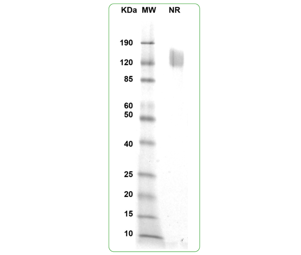 CD80 His SDS-PAGE