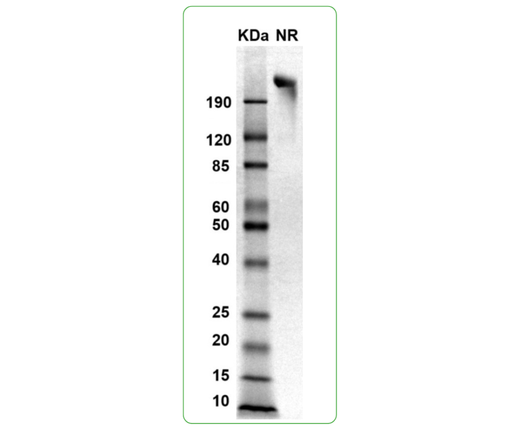 gp130 SDS PAGE