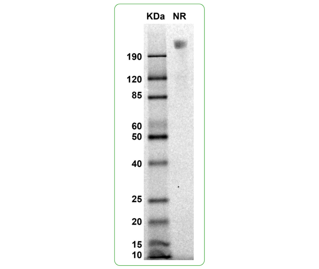 CD117 his tag Rhesus Macaque SDS-PAGE
