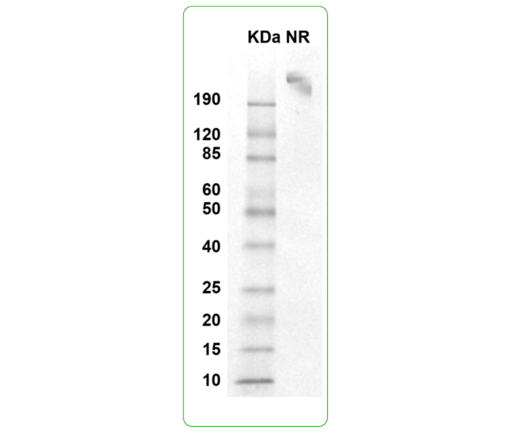 CD117 his tag human SDS PAGE