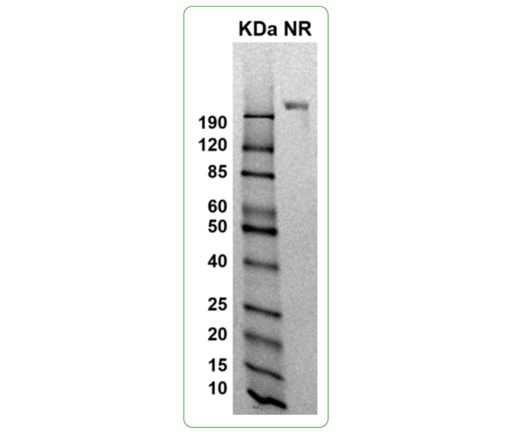 CD117 his tag mouse SDS-PAGE