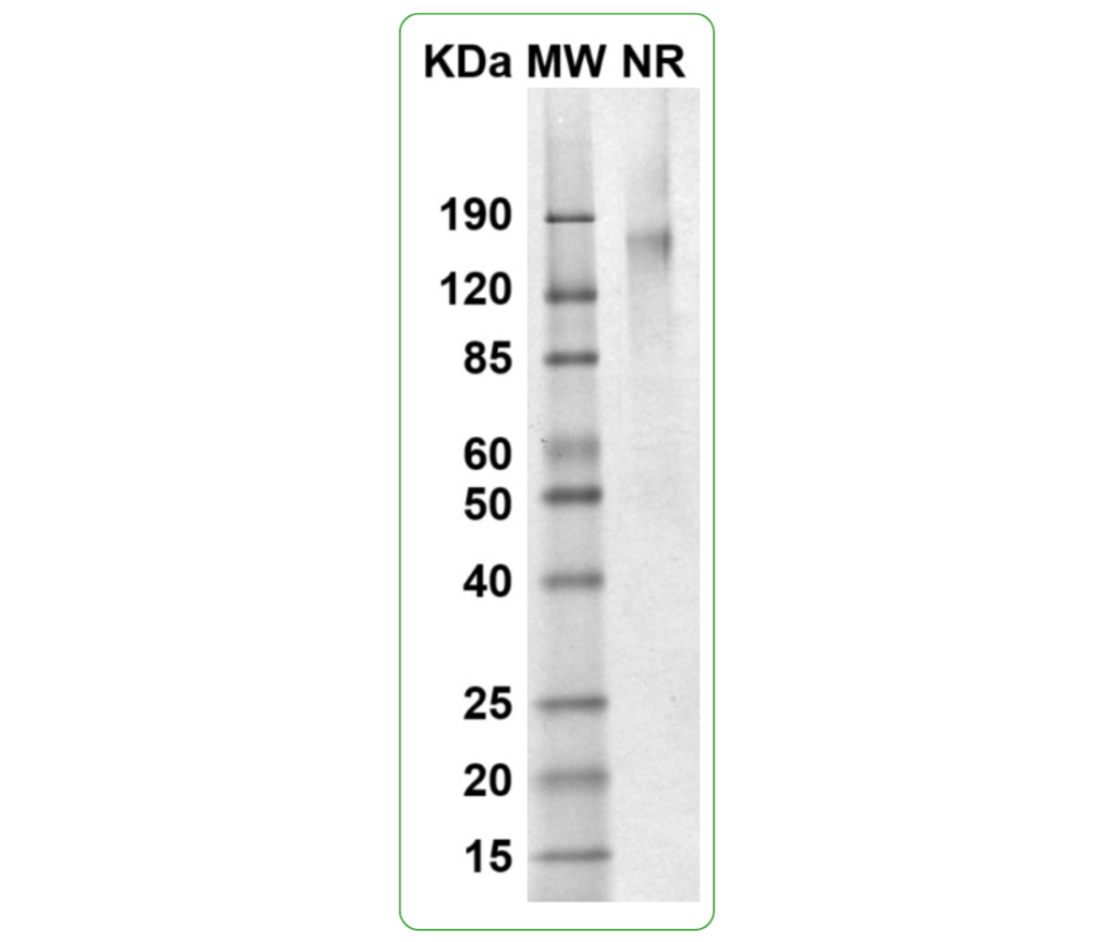 IL-2R beta gamma his-avi human SDS-PAGE