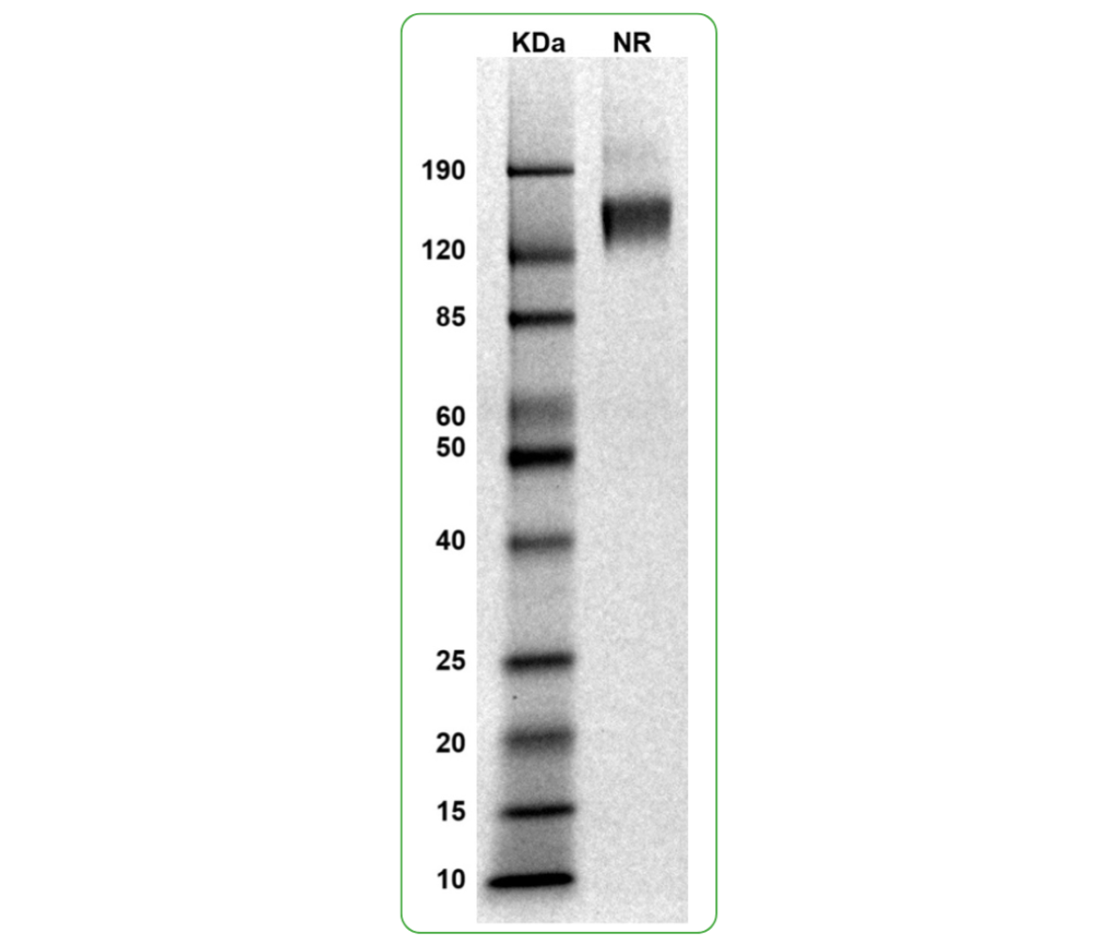 cd19 his tag human SDS-PAGE