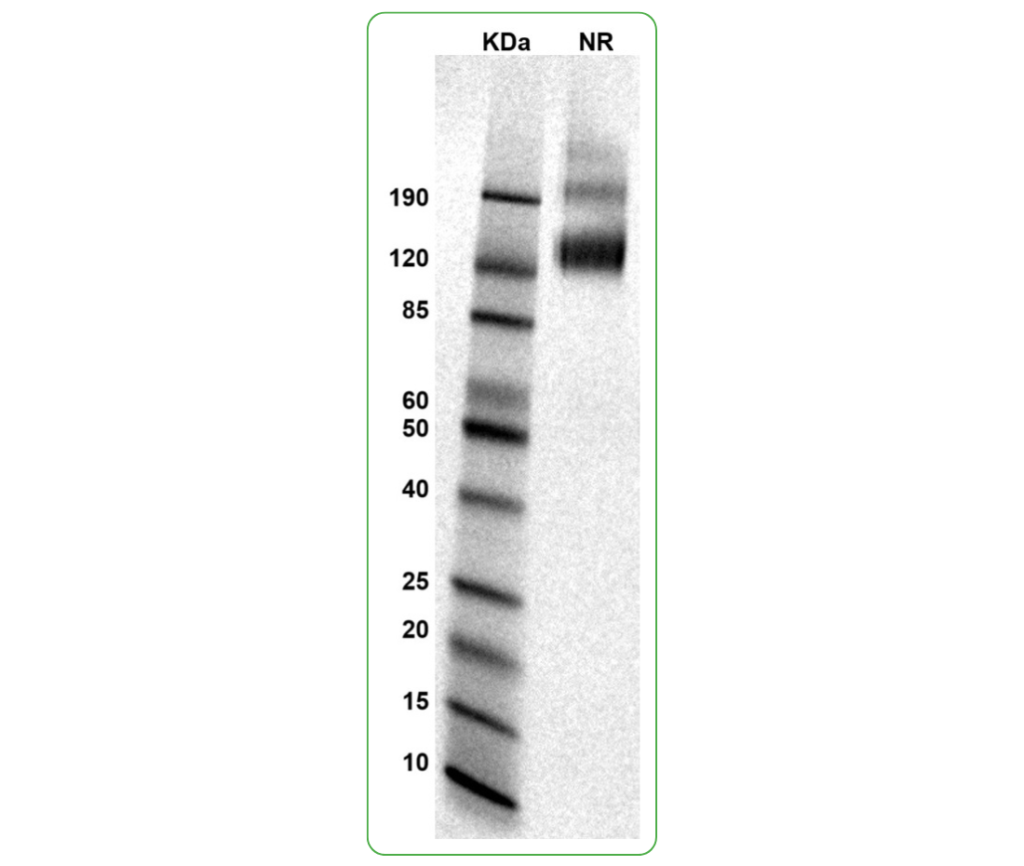 cd19 his tag mouse SDS-PAGE