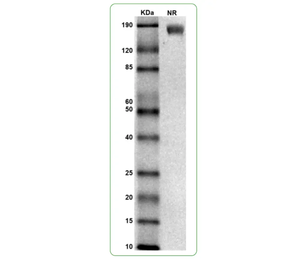 Human IL-6Ra Protein His SDS PAGE