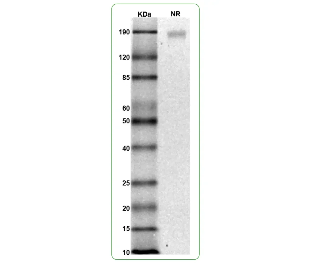 Human Siglec 9 Protein His SDS PAGE