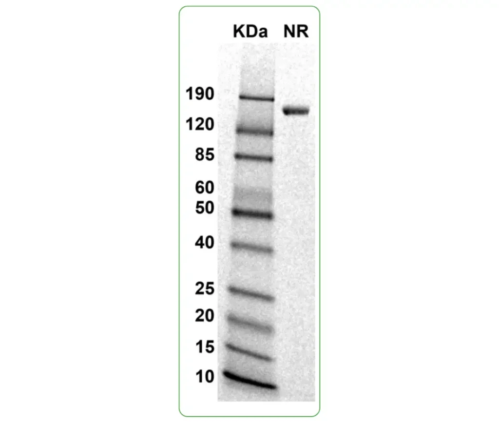 Rhesus macaque CD4 his SDS PAGE