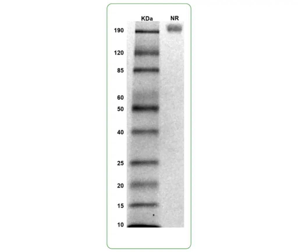 human TrkC protein His SDS-PAGE