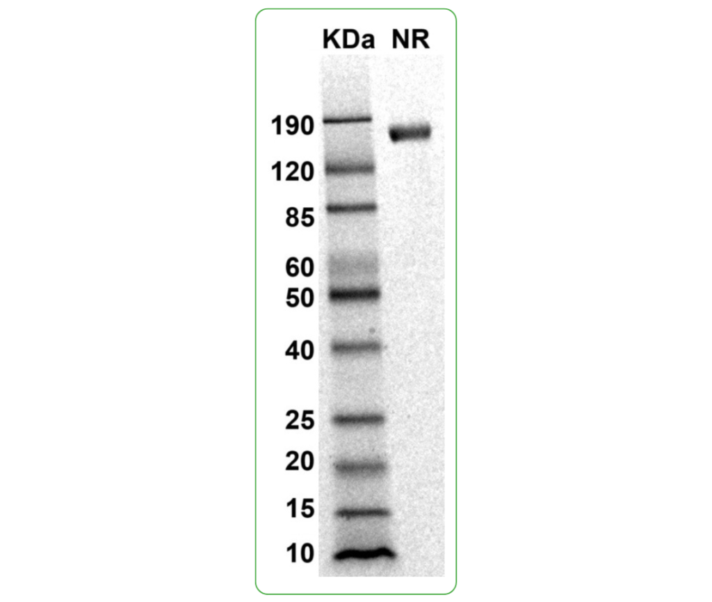 human siglec-6 protein his sds