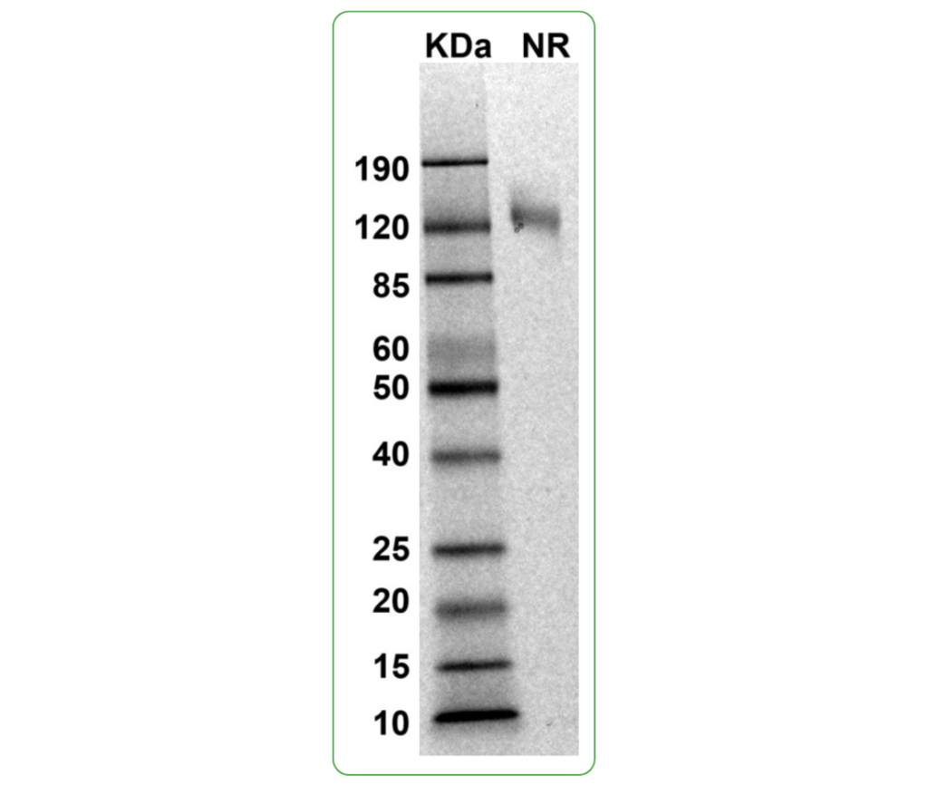 mouse TIGIT protein fc sds