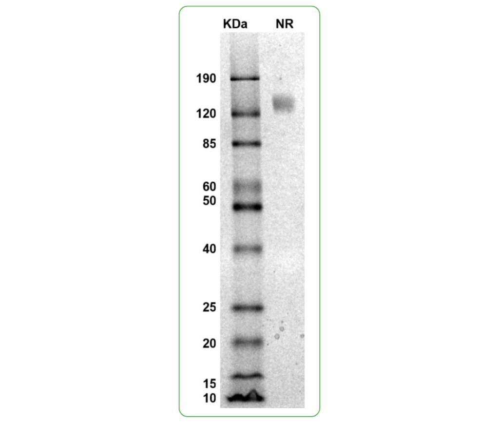 mouse ifngr1 protein his sds