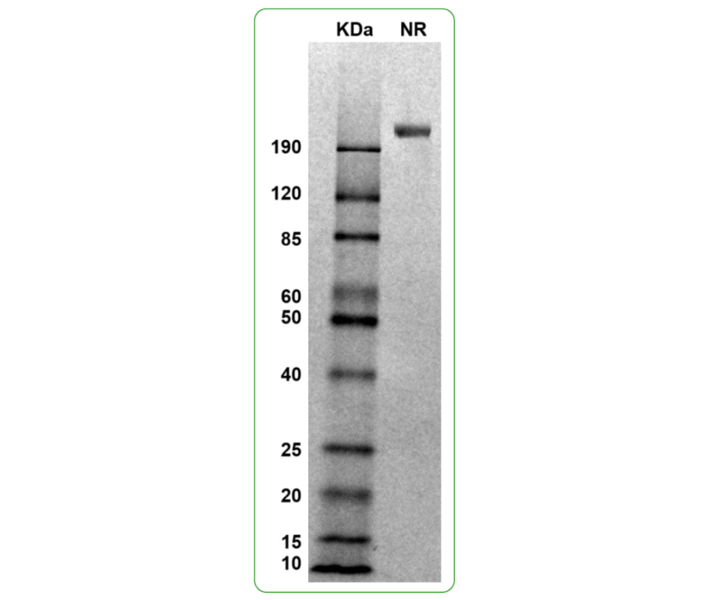 mouse il-6rb protein his sds