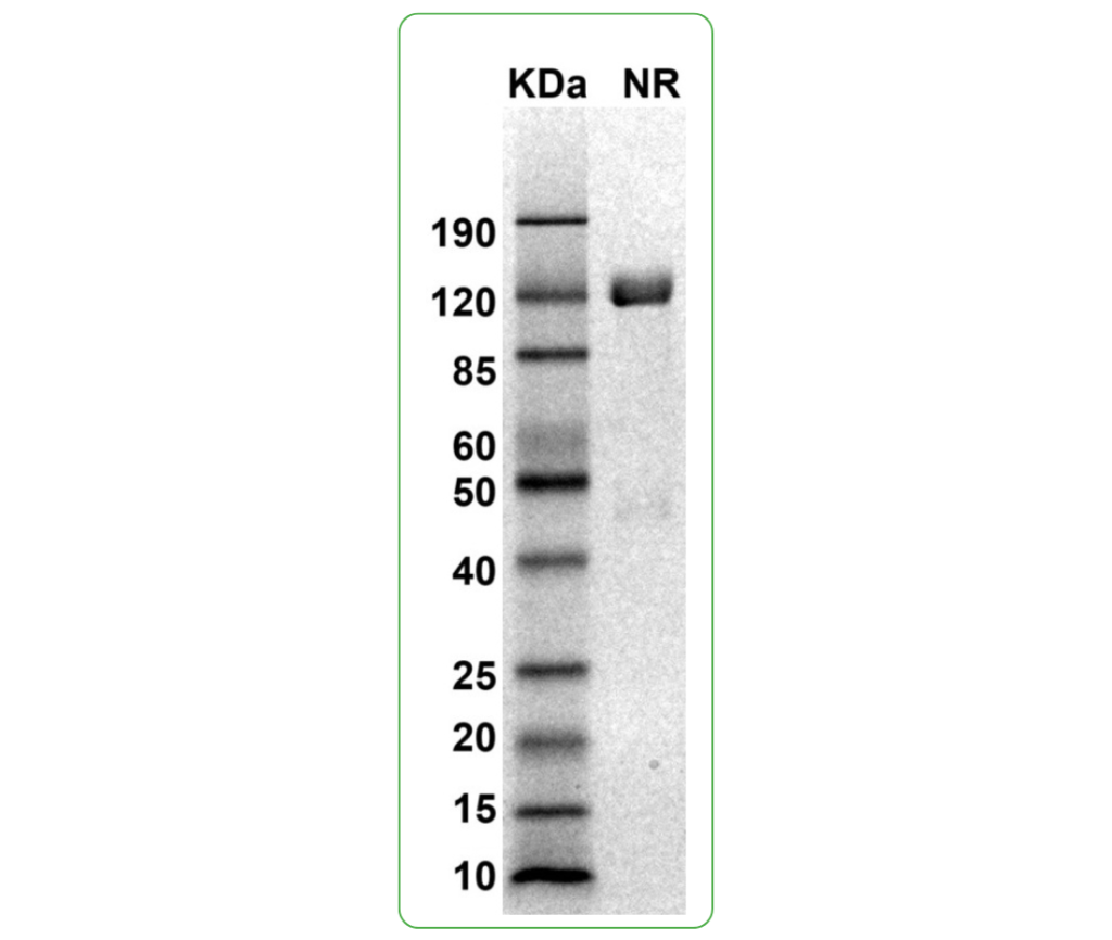 mouse pd-l1 his protein sds-page