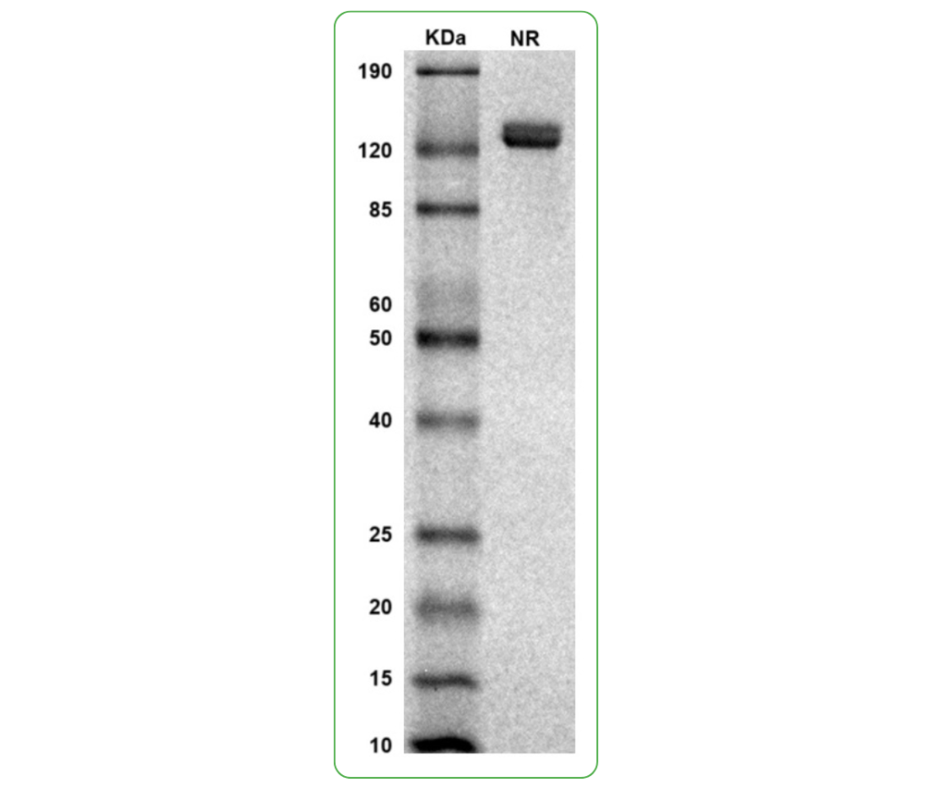 mouse PRLR protein his sds-page