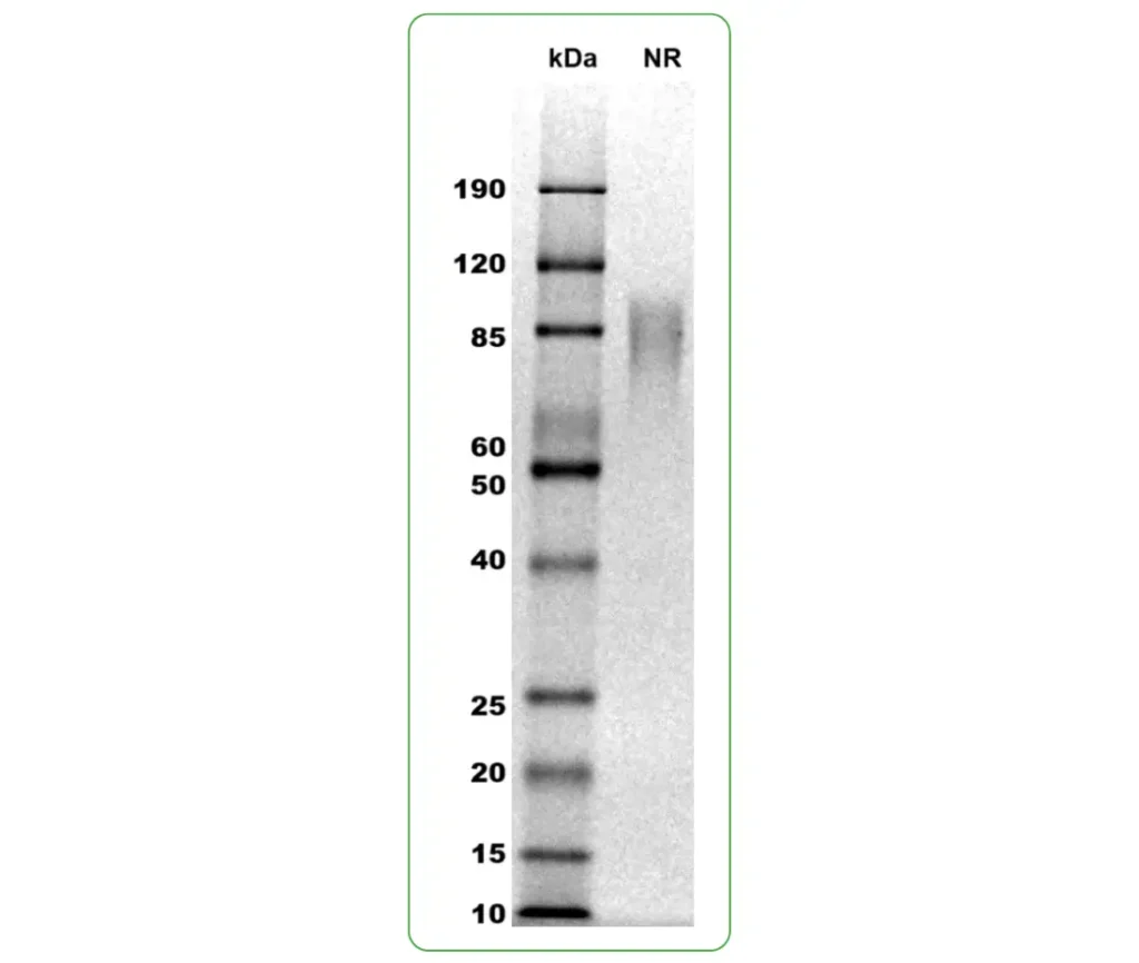 human ACVR2A protein his sds page