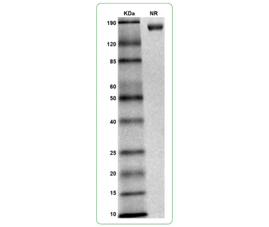 mouse IL-6Ra protein his sds page