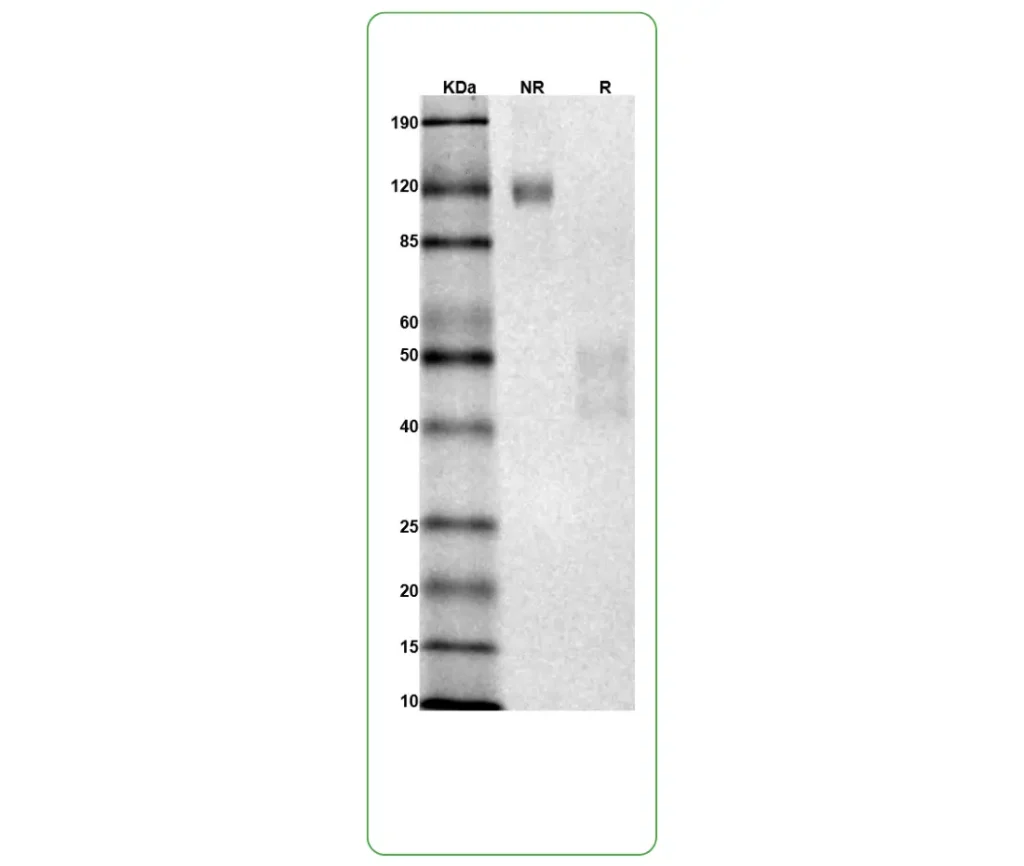 mouse IL-7RaTSLP R protein his strep sds page