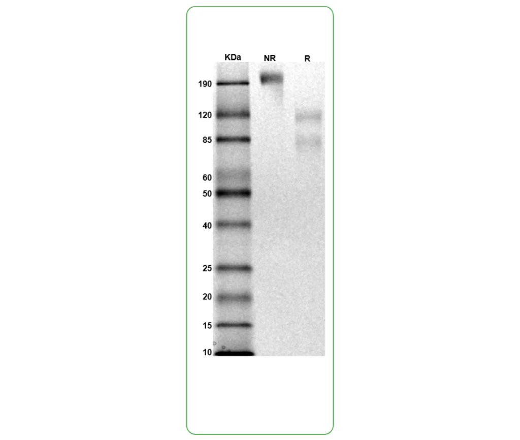 Human IL-6Ra-gp130 Protein Heterodimer His Strep Tag SDS PAGE