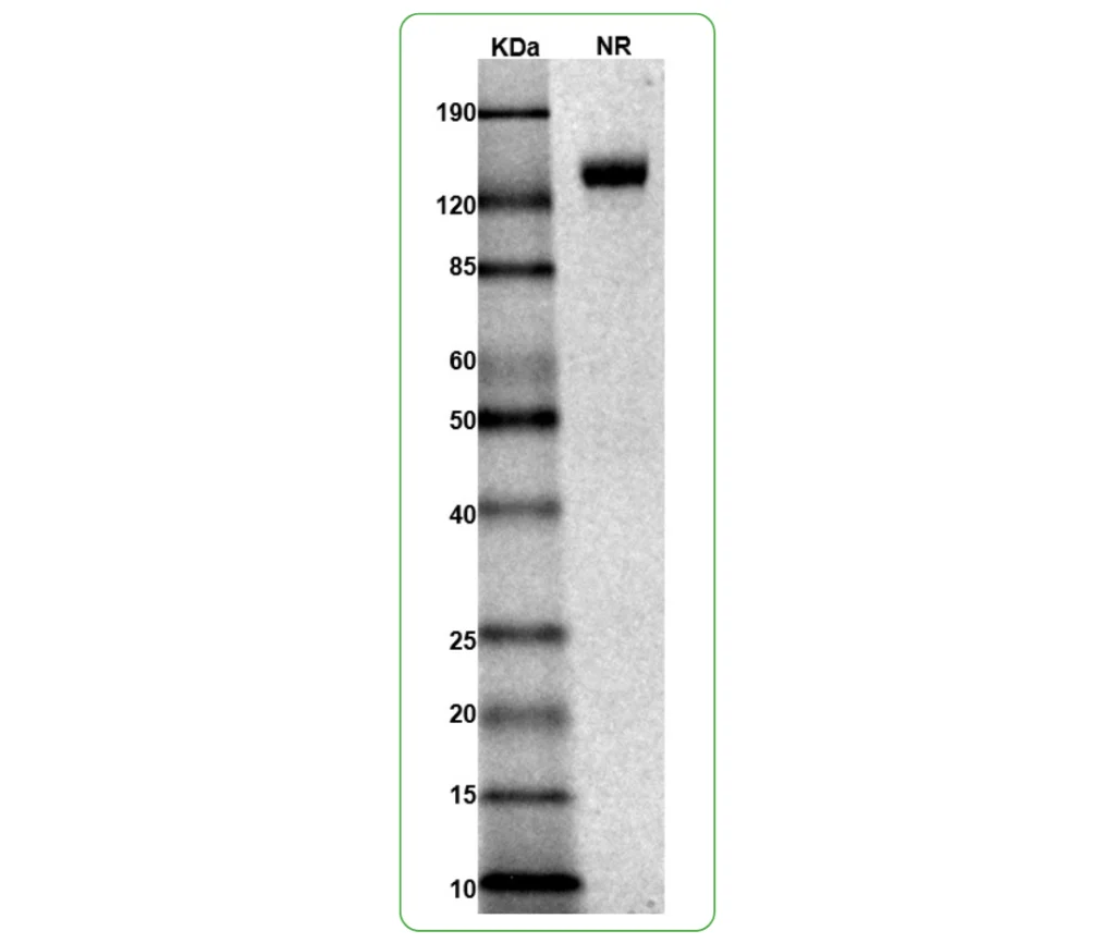 Mouse IL-4Ra Protein His Tag SDS