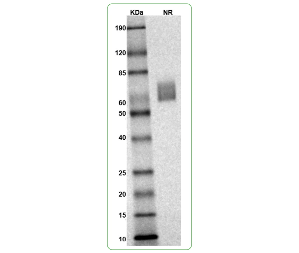 Rhesus macaque TIGIT Protein His Tag SDS