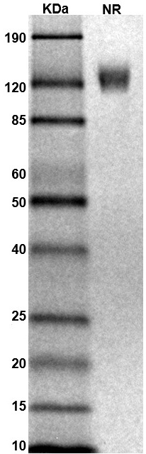 rhesus-macaque-ifnγr1-protein gel